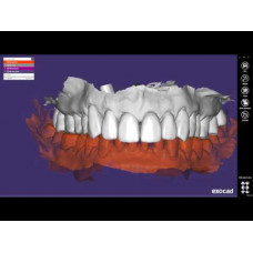 Wax-up CAD CAM 1 ед.